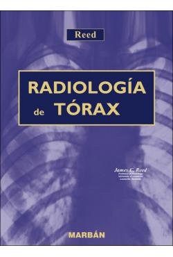 RADIOLOGIA DEL TORAX, de REED | portada del libro