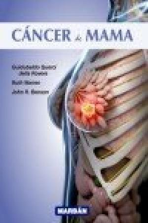 Cáncer de mama, de Querci della Rovere | portada del libro