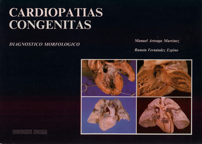 Cardiopatias congenitas, de Arteaga Martinez, Manuel | portada del libro