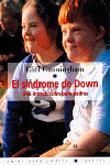 EL SINDROME DE DOWN, de CUNNINGHAM | portada del libro