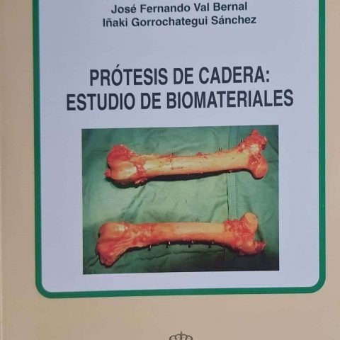 PROTESIS DE CADERA ESTUDIO DE BIOMATERIAL, de LOPEZ SASTRE, ANTONIO | portada del libro