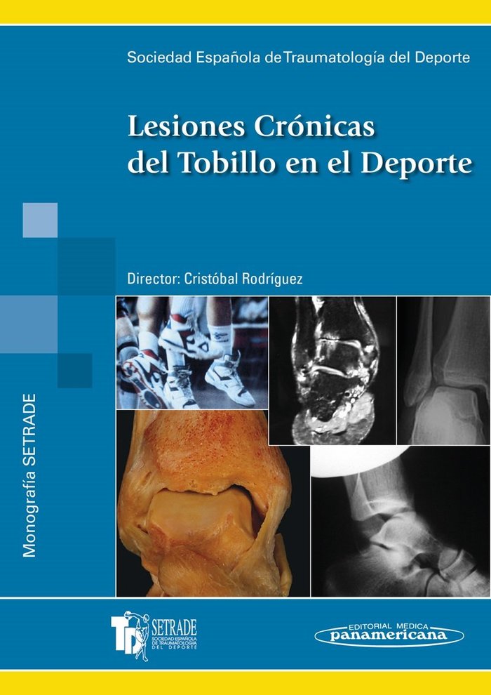 SETRADE:Lesiones Cronicas Tobillo Dep., de RODRíGUEZ HERNáNDEZ | portada del libro