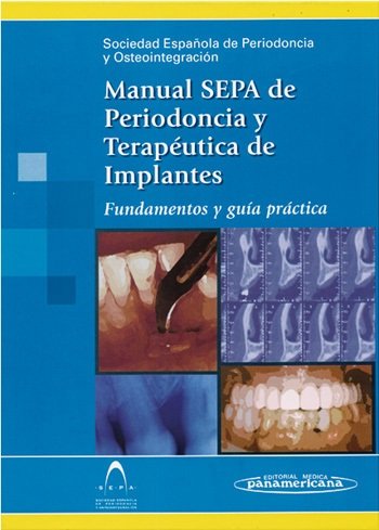 SEPA:Manual Periodoncia y Osteointegr., de ECHEVERRIA GARCIA, JOSE JAVIER | portada del libro