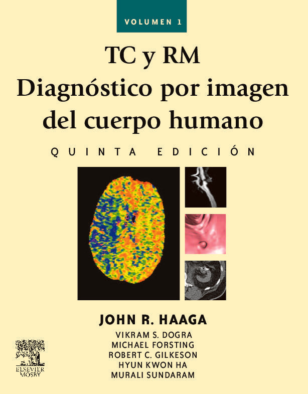 TC y RM. Diagnóstico por imagen del cuerpo humano, de HAAGA, JOHN R. | portada del libro