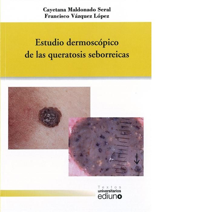 Estudio dermoscópico de las queratosis seborreicas, de Maldonado Seral | portada del libro