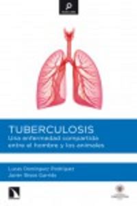 Tuberculosis, de Domínguez Rodríguez, Lucas | portada del libro