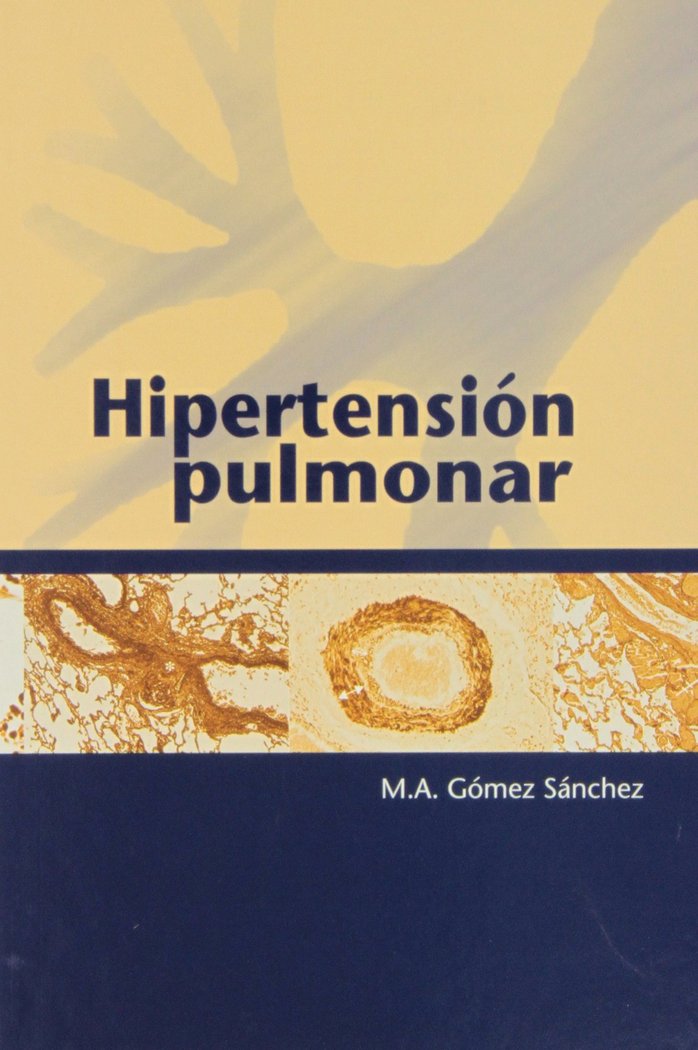 Hipertensión pulmonar, de GOMEZ SANCHEZ | portada del libro