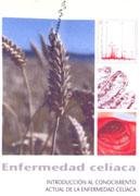 ENFERMEDAD CELIACA, de ARRANZ | portada del libro
