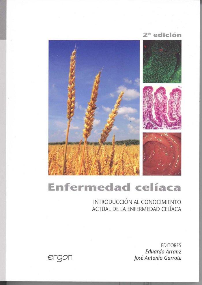 Enfermedad cel¡aca, de ARRANZ SANZ | portada del libro
