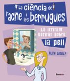 La ciència de l'acne i les berrugues, de Alex Woolf | portada del libro