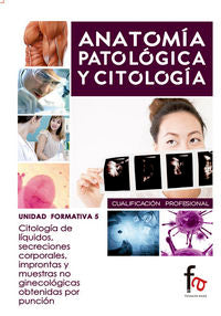 CITOLOGIA DE LIQUIDOS , SECRECIONES CORPORALES, IMPRONTAS Y MUESTRAS NO GINECOLOGICAS OBTENIDAS POR, de ALARCON LEIVA, MARIA 