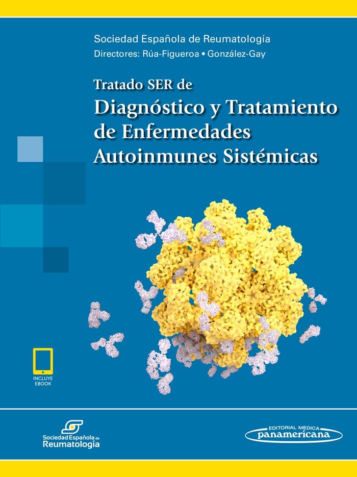 Tratado SER de Diagnóstico y Tratamiento de Enfermedades Autoinmunes Sistémicas (Incluye acceso a eB, de Sociedad Española de