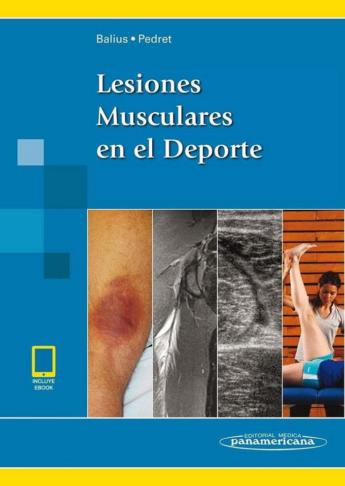 BALIUS:Lesiones Musculares en el Dep.+e, de balius | portada del libro