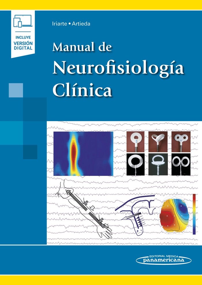 IRIARTE:Manual NeurofisiologÆa ClÆnica+e, de IRIARTE FRANCO, JORGE | portada del libro