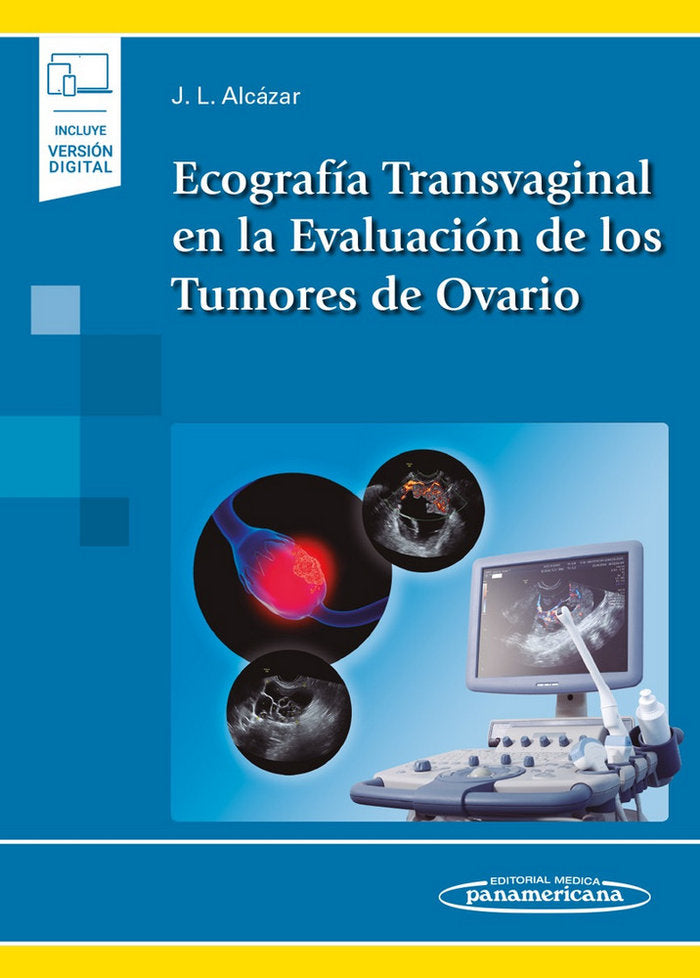 Ecografía Transvaginal en la Evaluación de los Tumores de Ovario (incluye versión digital), de Alcázar Zambrano, Juan Luis | 