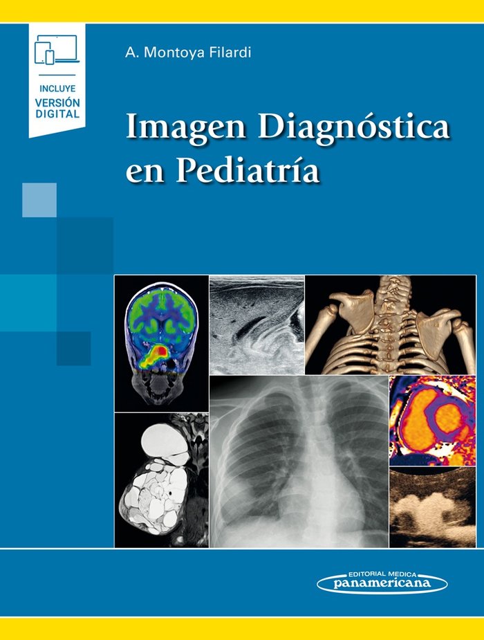 Imagen Diagnóstica en Pediatría (incluye versión digital), de Montoya Filardi, Alejandro | portada del libro