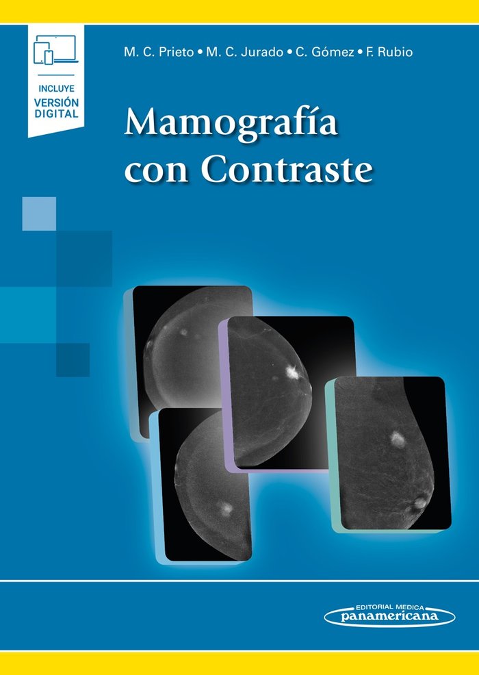 MAMOGRAFIA CON CONTRASTE, de PRIETO | portada del libro