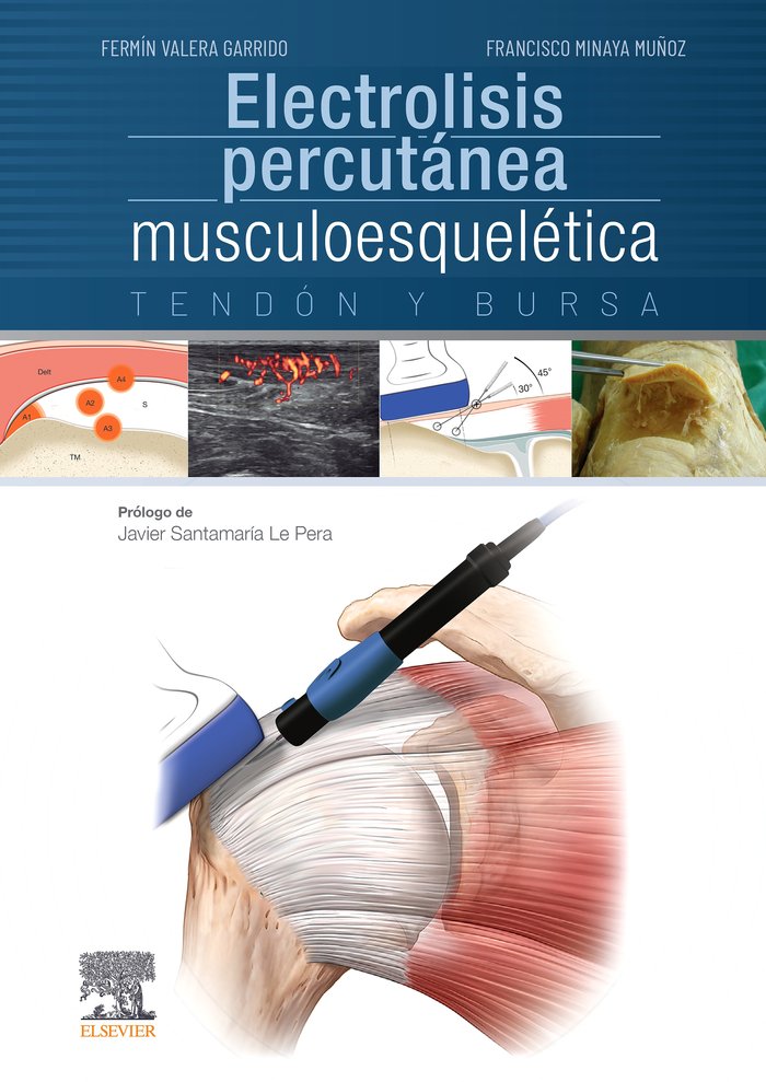 Electrolisis percutánea musculoesquelética. Tendón y bursa, de Valera Garrido, Fermín | portada del libro