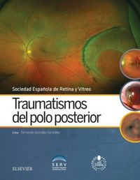 Traumatismos del polo posterior + acceso web, de Serv, Sociedad Española de Retina y Vítreo | portada del libro
