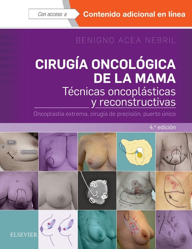 Cirugía oncológica de la mama (4ª ed.), de Acea Nebril, Benigno | portada del libro