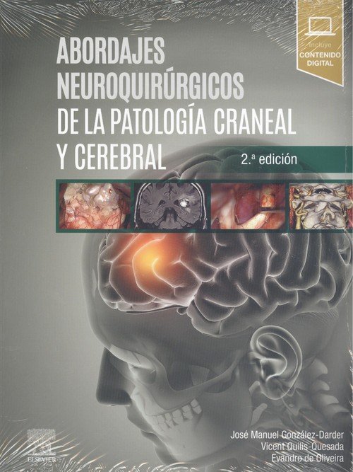 ABORDAJES NEUROQUIRURGICOS DE LA PATOLOGIA CRANEAL Y CEREBRAL, de GONZALEZ DARDIER,J M | portada del libro