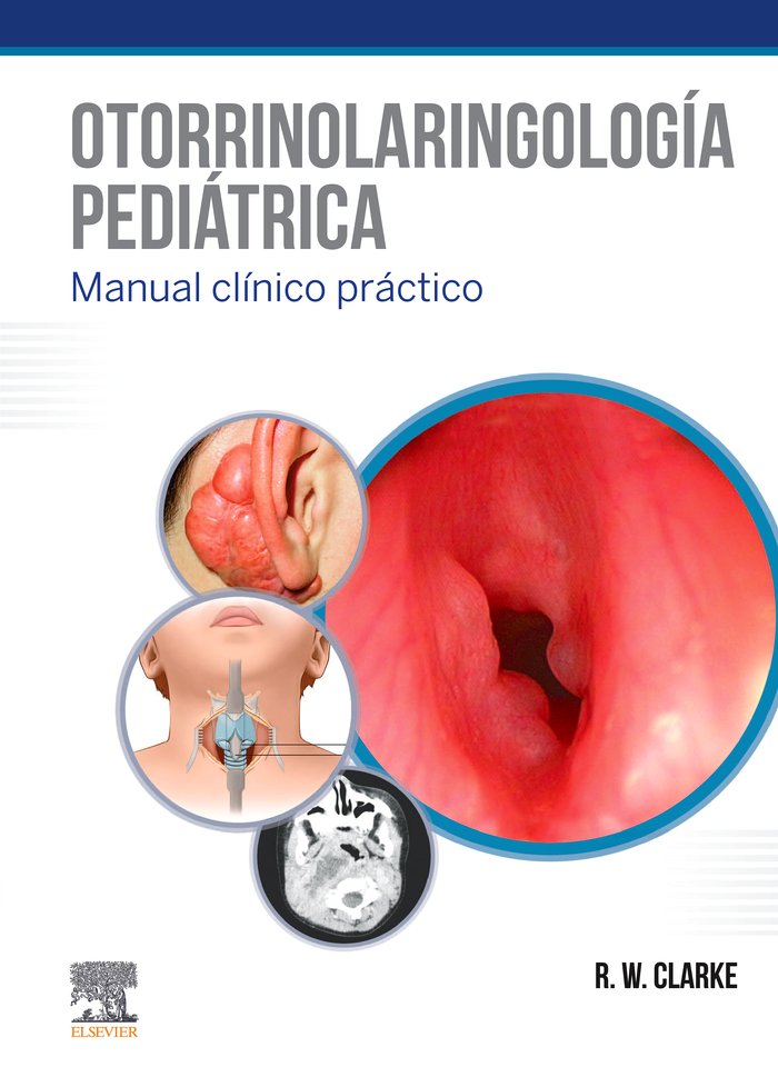 Otorrinolaringología pediátrica, de Clarke, Ray W. | portada del libro