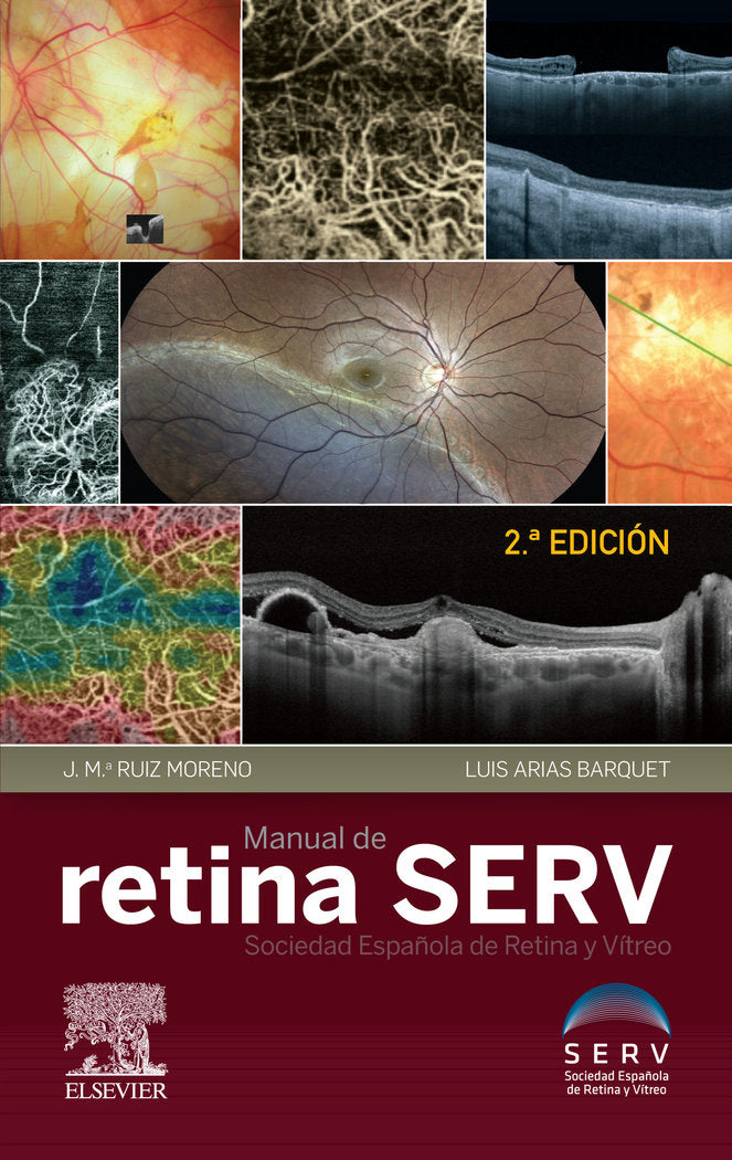 Manual de retina SERV (2ª ed.), de Serv, Sociedad Española De Retina Y Vítreo | portada del libro