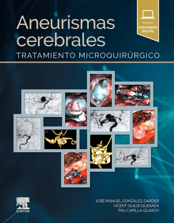 ANEURISMAS CEREBRALES, de AA.VV. | portada del libro