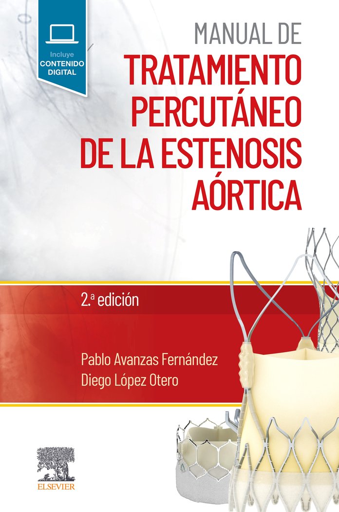 MANUAL DE TRTAMIENTO PERCUTANERO DE LA ESTENOSIS AORTICA, de AVANZAS FERNANDEZ,P | portada del libro