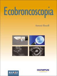 Ecobroncoscopia, de Varios autores | portada del libro