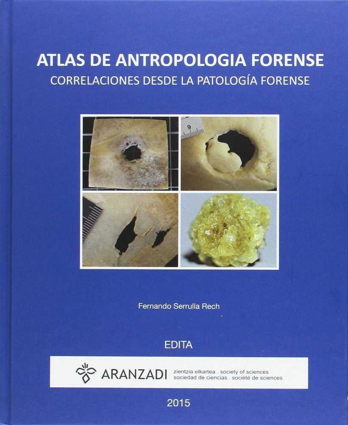 Atlas de antropología forense, de Varios autores | portada del libro