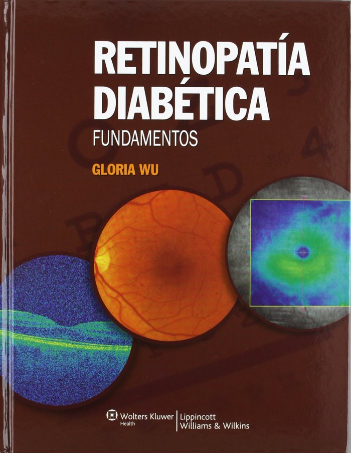 Retinopatía diabética, de Wu | portada del libro