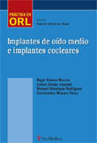 Implantes de o¡do medio e implantes cocleares, de RAMOS MACIAS, ANGEL | portada del libro