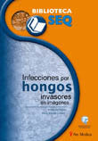 Infecciones por hongos invasores en imágenes, de PALACIO, AMALIA DEL | portada del libro