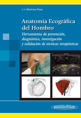 MARTINEZ PAYA:AnatomÆa Ecogrçf. Hombro, de MARTINEZ PAYA, JACINTO JAVIER | portada del libro