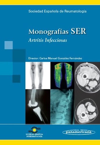SER:Artritis Infecciosas, de GONZALEZ FERNANDEZ, CARLOS MANUEL | portada del libro