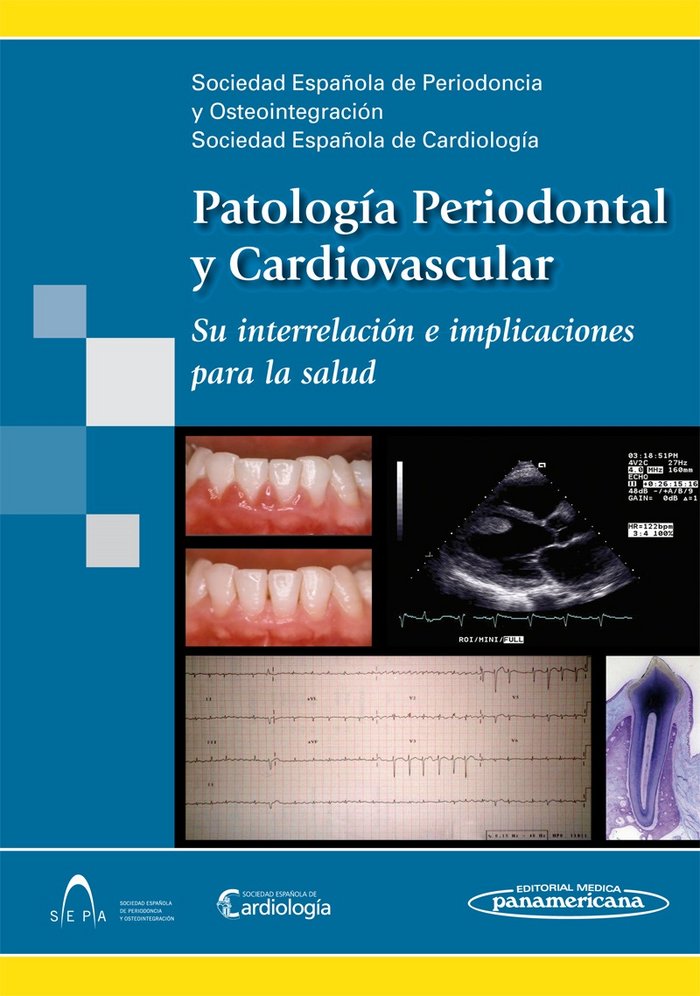 SEPA/SEC:Patolog. Peridontal y Cardiov., de SOCIEDAD ESPAÑOLA DE PERIODONCIA Y OSTEO | portada del libro