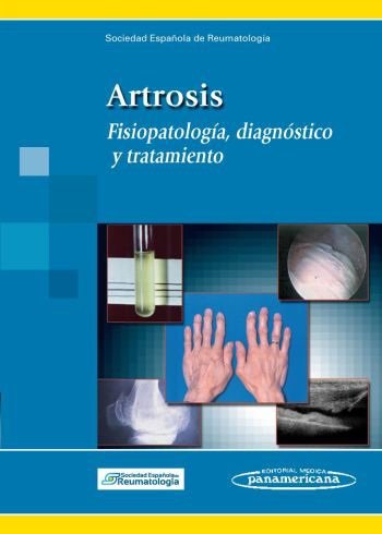 SER:Artrosis, de MONFORT FAURE, JORDI | portada del libro
