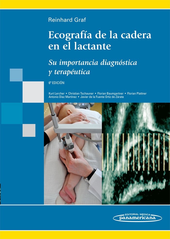 GRAF:EcografÆa Cadera en Lactante 6aEd, de GRAF, REINHARD | portada del libro