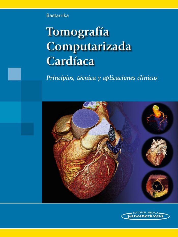 BASTARRIKA:Tomog.Computar. CardÆaca, de BASTARRIKA ALEMAñ, GORKA | portada del libro