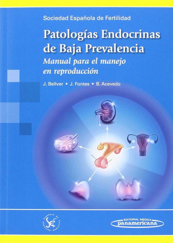 SEF:Patologia Endocrina Baja Prevalencia, de SEF SOCIEDAD ESPAÑOLA DE FERTILIDAD | portada del libro