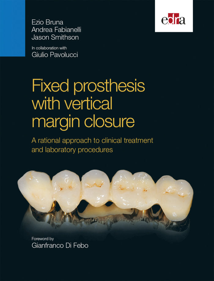 Fixed prosthesis with vertical margin closure. A rational approach to clinical treatment and laborat, de Bruna, Ezio | portad