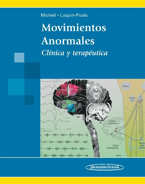 MICHELI:Movimien.Anormales Involuntarios, de MICHELI | portada del libro