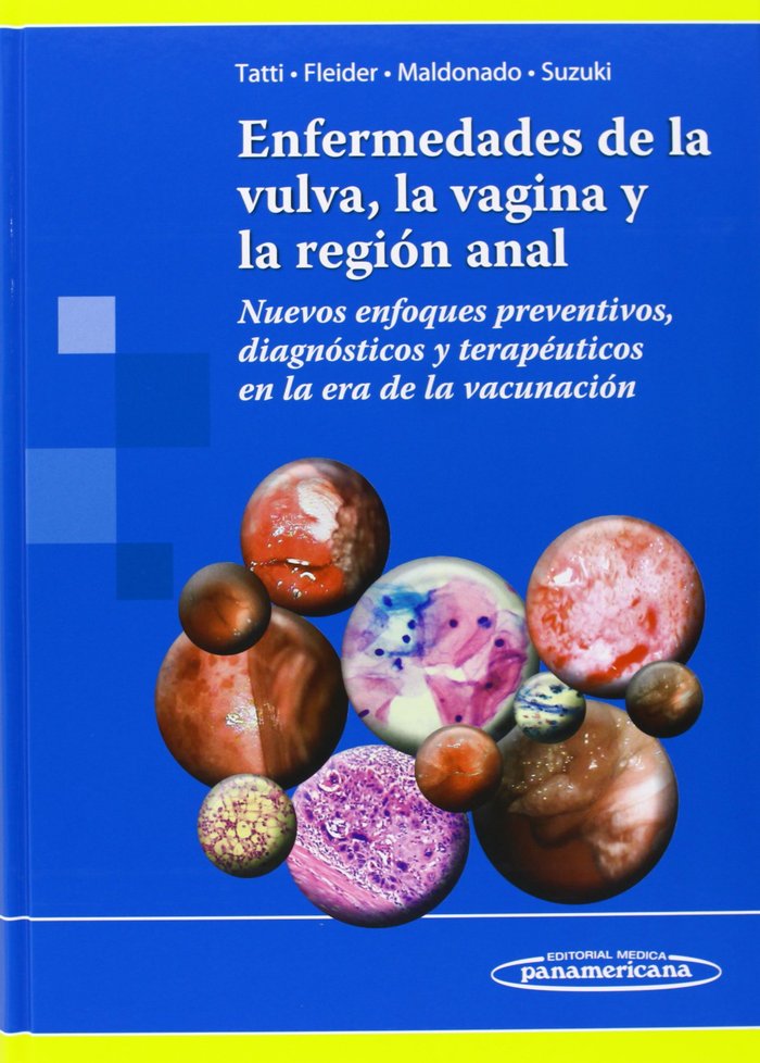 TATTI:Enfermedades de la Vulva, de TATTI, SILVIO | portada del libro
