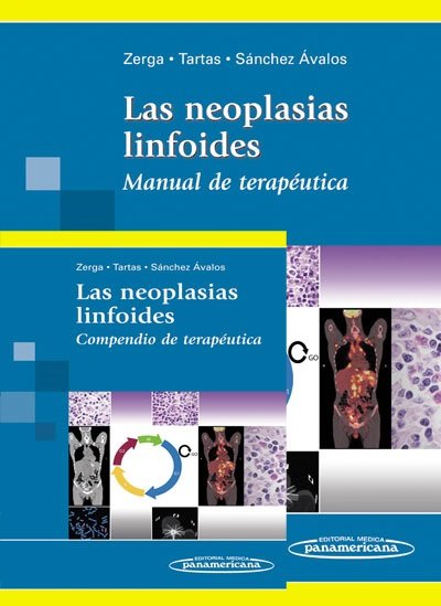 LAS NEOPLASIAS LINFOIDES, de ZERGA | portada del libro