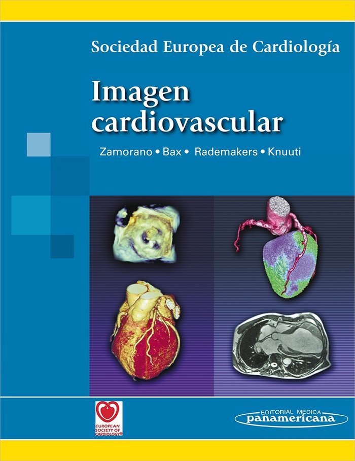 SEC-ZAMORANO:Imagen Cardiovascular, de SOCIEDAD EUROPEA DE CARDIOLOGIA, ZAMORAN | portada del libro