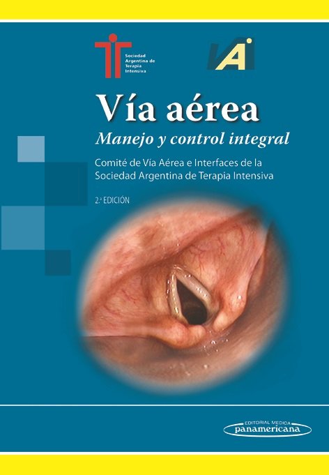 SATI:VÆa AÄrea 2a Ed, de (SOCIEDAD ARGENTINA DE TERAPIA INTENSIVA), SATI | portada del libro