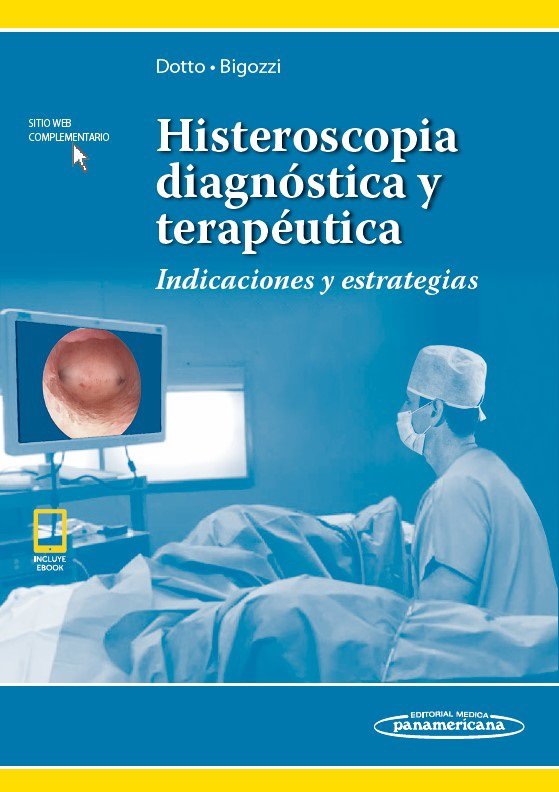 Histeroscopia diagnóstica y terapéutica, de Jorge E. Dotto,Miguel Ángel Bigozzi (h.) | portada del libro