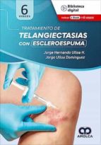 ULLOA TRATAMIENTO DE TELANGIECTASIAS CON ESCLEROESPUMA, de JORGE HERNANDO ULLOA | portada del libro