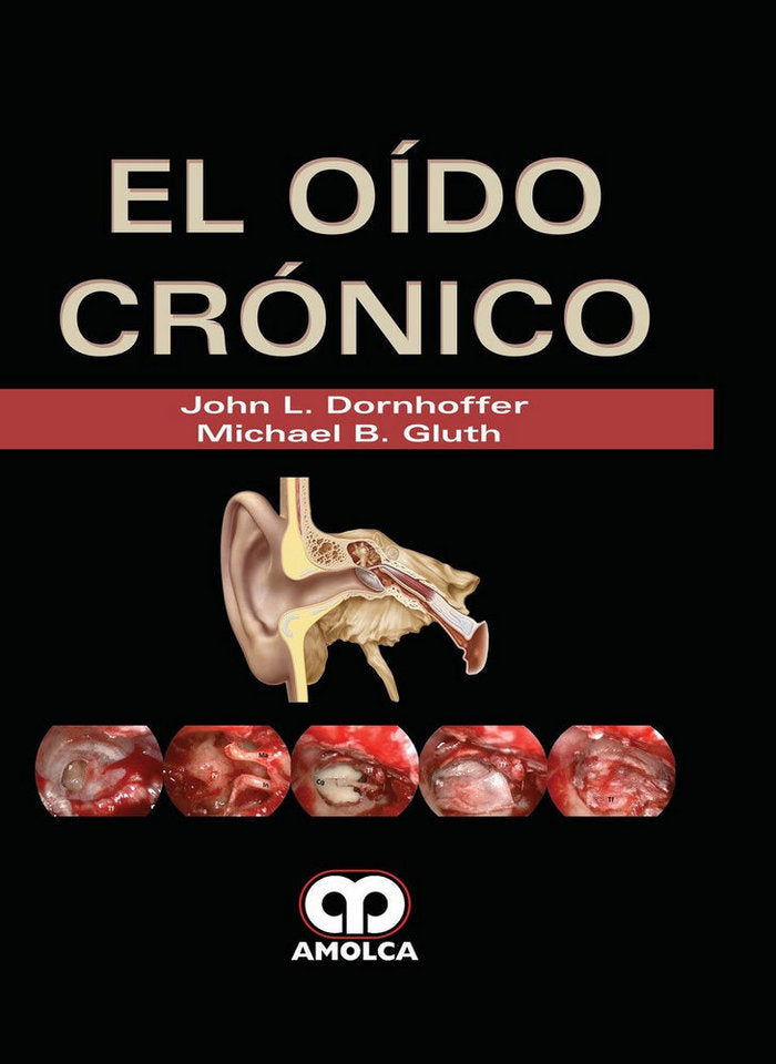 EL OIDO CRONICO ** (NOVEDAD DICIEMBRE 2017), de Varios autores | portada del libro